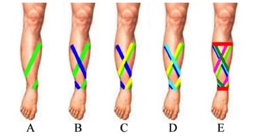 Ongebruikt Strapping for Shin splints (A Guide To Strapping Your Shins For Pain) HE-66