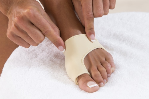 Bunion Treatment, Image by ModPod Sports Podiatry