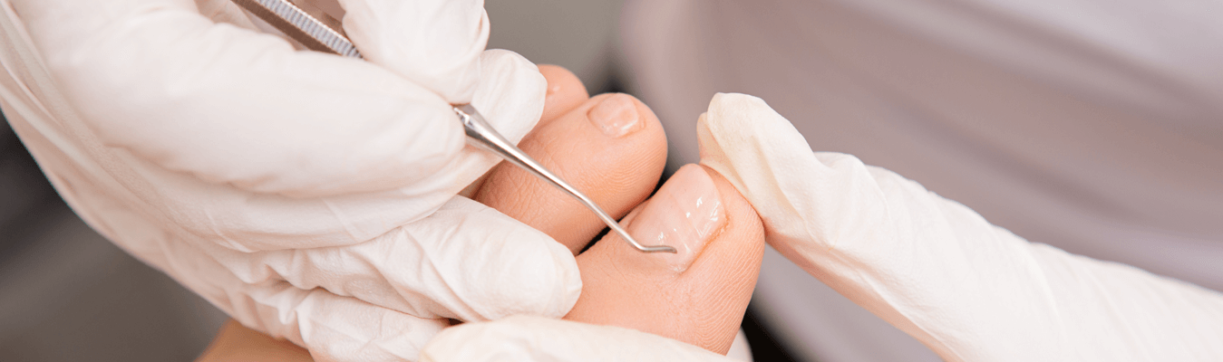 Nail Surgery | Plastic Surgery Key