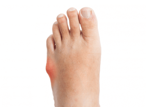 Podiatrist Sydney Cbd