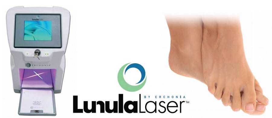 Laser treatment for toenail fungus: Does it work?