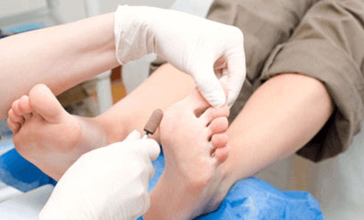 Medical Pedicure Sydney