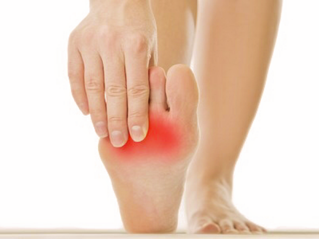 Metatarsal Bursitis
