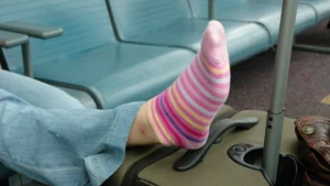 Swollen Ankles After Flying