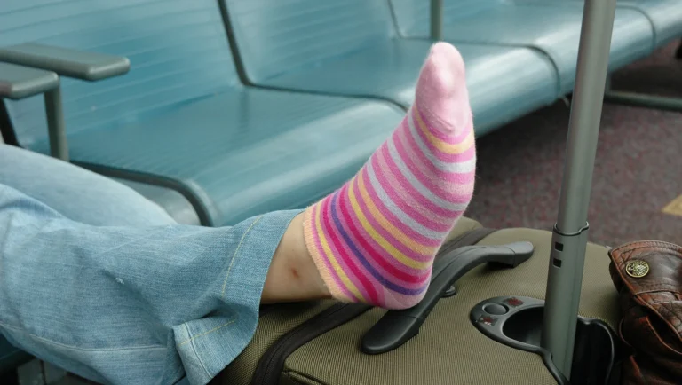 Swollen Ankles After Flying