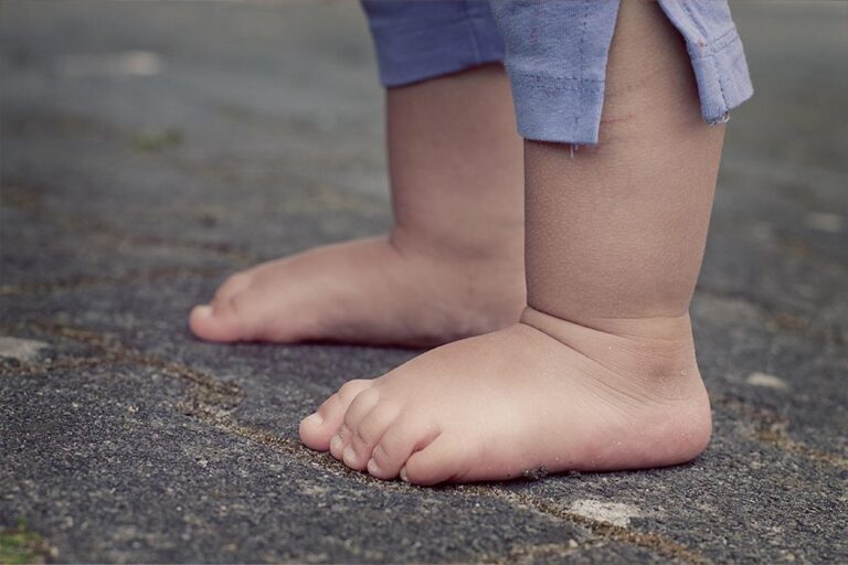 Flat Feet In Children