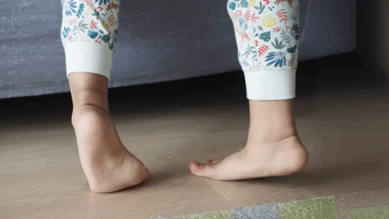 Pigeon Toes in Children