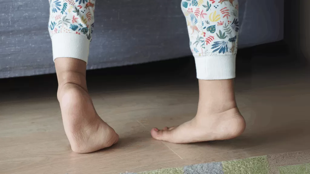Pigeon Toes in Children