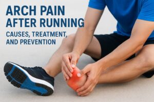 Arch Pain After Running: Causes, Treatment, And Prevention